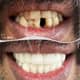 Slider image (9) A-Dent Dental Clinic in Antalya, Turkey